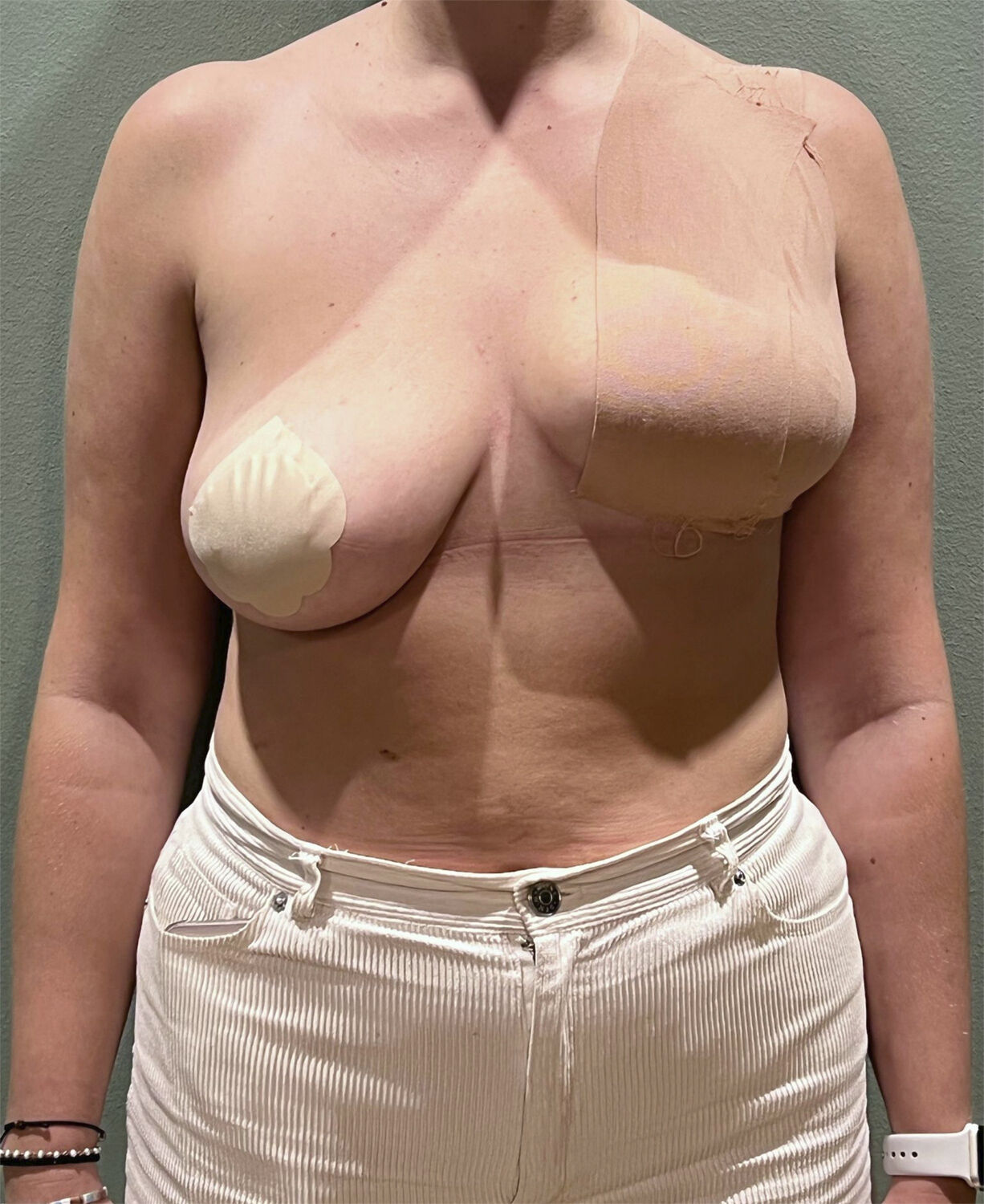 AISO Breast Tape 5cm Nilla